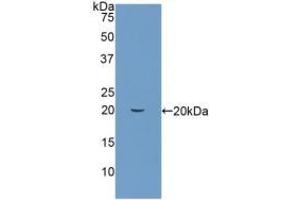 Detection of Recombinant PIN1, Human using Polyclonal Antibody to Peptidyl Prolyl Cis/Trans Isomerase NIMA Interacting Protein 1 (PIN1) (PIN1 Antikörper  (AA 2-163))