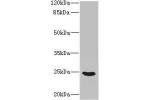 Western blot All lanes: FGF19 antibody IgG at 3. (FGF19 Antikörper  (AA 25-216))