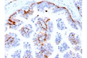 Formalin-fixed, paraffin-embedded human Prostate stained with Cystatin A Mouse Monoclonal Antibody (CSTA/2882).