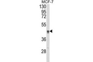 Western Blotting (WB) image for anti-Trans-Golgi Network Protein 2 (TGOLN2) antibody (ABIN3003981) (TGOLN2 Antikörper)