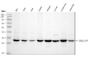 Western blot analysis of TOLLIP using anti-TOLLIP antibody (ABIN7599202).
