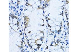 Immunohistochemistry of paraffin-embedded Human stomach using VIL1 Polyclonal Antibody at dilution of 1:100 (40x lens).