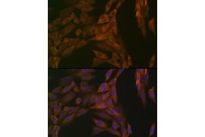 Immunofluorescence (IF) image for anti-Protein Phosphatase 2, Catalytic Subunit, beta Isozyme (PPP2CB) antibody (ABIN7269686)