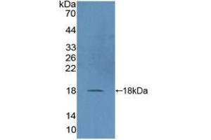 Detection of Recombinant DUSP5, Human using Polyclonal Antibody to Dual Specificity Phosphatase 5 (DUSP5) (DUSP5 Antikörper  (AA 1-135))