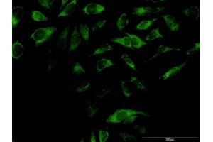 Immunofluorescence of purified MaxPab antibody to OXA1L on HeLa cell. (OXA1L Antikörper  (AA 1-435))