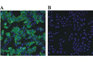 Immunofluorescence (IF) image for Rabbit anti-Chicken IgY antibody (DyLight 488) (ABIN1450234) (Kaninchen anti-Huhn IgY Antikörper (DyLight 488))