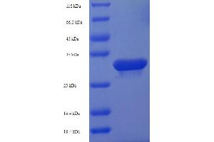 SDS-PAGE (SDS) image for HD Domain Containing 3 (HDDC3) (AA 2-140) protein (His-SUMO Tag) (ABIN5711567) (HDDC3 Protein (AA 2-140) (His-SUMO Tag))