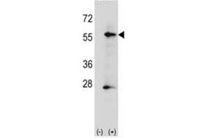 Western blot analysis of placental Alkaline Phosphatase antibody and 293 cell lysate (2 ug/lane) either nontransfected (Lane 1) or transiently transfected (2) with the ALPP gene. (Alkaline Phosphatase Antikörper  (AA 56-83))
