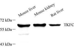 Western blot analysis of DAK (ABIN7073737),at dilution of 1: 1000,Lane 1: Mouse liver tissue lysate,Lane 2: Mouse kidney tissue lysate,Lane 3: Rat liver tissue lysate (DAK Antikörper)