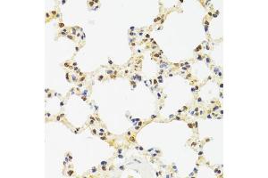 Immunohistochemistry of paraffin-embedded rat lung using SUZ12 antibody (ABIN5975314) at dilution of 1/100 (40x lens). (SUZ12 Antikörper)