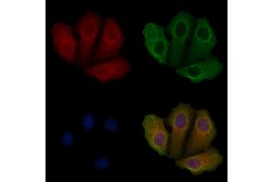 ABIN6259201 and ABIN6275855 staining Hela cells by IF/ICC. (STK33 Antikörper  (N-Term))