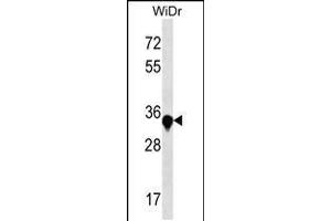 Western blot analysis in WiDr cell line lysates (35ug/lane). (AMMECR1 Antikörper  (C-Term))