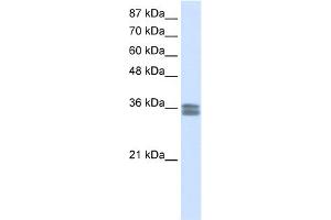 WB Suggested Anti-CACNG4 Antibody Titration:  0. (CACNG4 Antikörper  (N-Term))