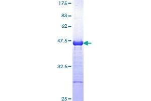 CBL Protein (AA 736-835) (GST tag)