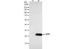 IP Image SPR antibody [N2C3] immunoprecipitates SPR protein in IP experiments. (SPR Antikörper)