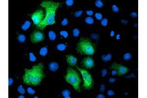 Anti-PGAM2 mouse monoclonal antibody (ABIN2454954) immunofluorescent staining of COS7 cells transiently transfected by pCMV6-ENTRY PGAM2 (RC200701). (PGAM2 Antikörper)