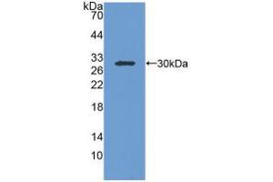 Western blot analysis of recombinant Human IGFBP1. (IGFBPI Antikörper  (AA 36-235))