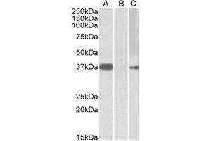 HEK293 lysate (10µg protein in RIPA buffer) overexpressing Human MYF6 with MYC tag probed with AP21502PU-N (0. (MYF6 Antikörper  (Internal Region))
