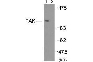 Western blot analysis of extracts from HeLa cells using FAK (Ab-925) antibody (#B7083). (FAK Antikörper  (Tyr925))