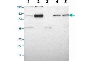USP13 anticorps
