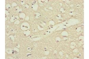 Immunohistochemistry of paraffin-embedded human brain tissue using ABIN7157675 at dilution of 1:100 (DSN1 Antikörper  (AA 1-356))