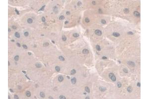 IHC-P analysis of Human Liver Tissue, with DAB staining. (HFE2 Antikörper  (AA 234-416))