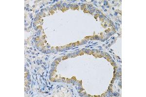 Immunohistochemistry (Paraffin-embedded Sections) (IHC (p)) image for anti-Adaptor-Related Protein Complex 2, beta 1 Subunit (AP2B1) (AA 752-951) antibody (ABIN3015810)