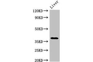Western Blot Positive WB detected in: Rat liver tissue All lanes: PRKAG1 antibody at 3 μg/mL Secondary Goat polyclonal to rabbit IgG at 1/50000 dilution Predicted band size: 38, 35, 39 kDa Observed band size: 38 kDa