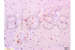 Formalin-fixed and paraffin embedded rat brain labeled with Anti-GDNF Polyclonal Antibody, Unconjugated (ABIN736536) at 1:200 followed by conjugation to the secondary antibody and DAB staining. (GDNF Antikörper  (AA 121-211))