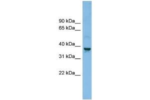 WB Suggested Anti-SLC30A3 Antibody Titration: 0. (Slc30a3 Antikörper  (Middle Region))