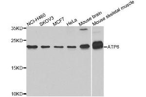 Western blot analysis of extracts of various cell lines, using ATP6 antibody. (MT-ATP6 Antikörper  (C-Term))