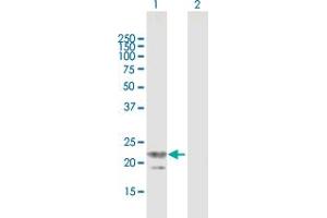 Western Blot analysis of TRGV3 expression in transfected 293T cell line by TRGV3 MaxPab polyclonal antibody.