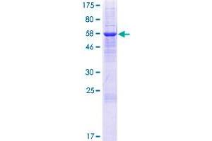 SDS-PAGE (SDS) image for Iodotyrosine Deiodinase (IYD) (AA 1-289) protein (GST tag) (ABIN1803396) (IYD Protein (AA 1-289) (GST tag))