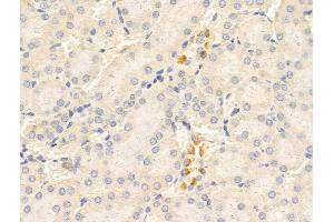 ABIN6265820 and ABIN6268771 at 1/100 staining Rat kidney tissue by IHC-P. (TYK2 Antikörper  (C-Term))