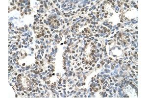 MAGEA8 antibody was used for immunohistochemistry at a concentration of 16. (MAGEA8 Antikörper  (N-Term))