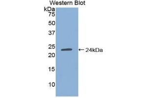 Detection of Recombinant TIMP4, Human using Polyclonal Antibody to Tissue Inhibitors Of Metalloproteinase 4 (TIMP4) (TIMP4 Antikörper  (AA 32-224))