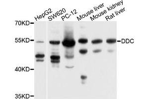 Western blot analysis of extracts of various cells, using DDC antibody. (DDC Antikörper)