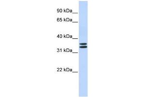WB Suggested Anti-TAL1 Antibody Titration: 0. (TAL1 Antikörper  (N-Term))