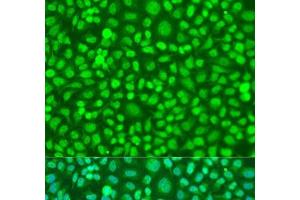 Immunofluorescence analysis of U2OS cells using COQ7 Polyclonal Antibody at dilution of 1:100. (Coq7 Antikörper)