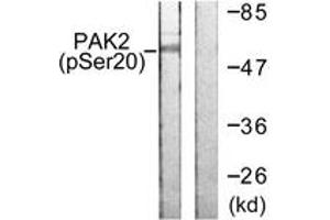 Western blot analysis of extracts from 293 cells treated with Sorbitol 0. (PAK2 Antikörper  (pSer20))