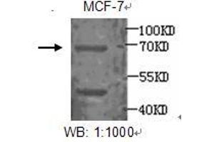 Image no. 1 for anti-Estrogen Receptor 1 (ESR1) antibody (ABIN790861) (Estrogen Receptor alpha Antikörper)