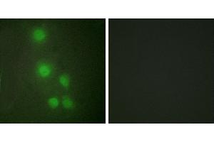 Peptide - +Western blot analysis of extracts from Jurkat cells and COLO205 cells, using ACL6A antibody. (BAF53A Antikörper  (Internal Region))