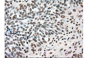 Immunohistochemical staining of paraffin-embedded colon tissue using anti-TYRO3mouse monoclonal antibody. (TYRO3 Antikörper)