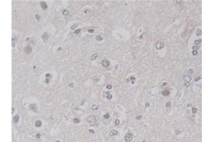 Immunohistochemistry (IHC) image for anti-Lactamase, beta (LACTB) (AA 313-547) antibody (ABIN7436687)