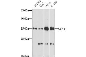 Western blot analysis of extracts of various cell lines, using CLN8 antibody (ABIN7266285) at 1:1000 dilution. (CLN8 Antikörper)