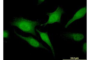 Immunofluorescence of monoclonal antibody to RGS20 on HeLa cell. (RGS20 Antikörper  (AA 78-176))