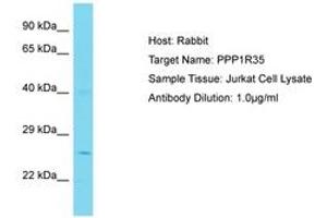 Image no. 1 for anti-Protein Phosphatase 1, Regulatory Subunit 35 (PPP1R35) (N-Term) antibody (ABIN6750778)