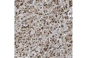 Immunohistochemical staining of human adrenal gland with RRP1B polyclonal antibody  shows strong nuclear positivity in cortical cells at 1:500-1:1000 dilution. (RRP1B Antikörper)