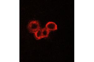 ABIN6269075 staining A549 cells by ICC/IF. (EGFR Antikörper  (C-Term))
