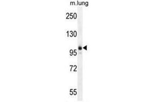 AEBP1 Antibody (Center) western blot analysis in mouse lung tissue lysates (35µg/lane).